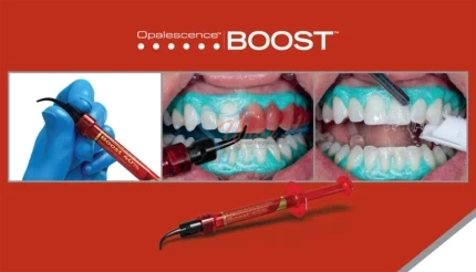 Opalescence Boost Ultradent USA Original